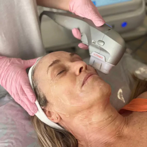 Facial con HIFU - comprar online