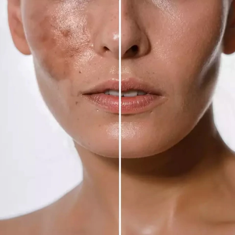 Manchas OFF - comprar online