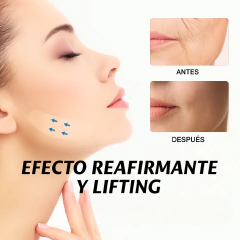 PARCHES V-SHAPED®: ELIMINA LAS ARRUGAS DE FORMA PERMANENTE (40unds) en internet