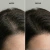 Shampoo Anticaspa Dandruff 300ml - loja online