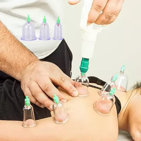 X6 Ventosas Chinas Copas Corporales Cupping Vacumterapia