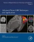 Advanced Neuro MR Techniques and Applications
