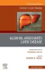 Alcohol-Associated Liver Disease, An Issue of Clinics in Liver Disease