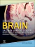 Diagnostic Imaging: Brain