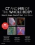 CT and MRI of the Whole Body - Electronic