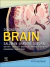 Diagnostic Imaging: Brain