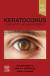 Keratoconus,E-Book