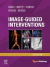 Image-Guided Interventions