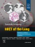 Specialty Imaging: HRCT of the Lung