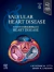 Valvular Heart Disease