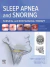 Sleep Apnea and Snoring
