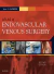 Atlas of Endovascular Venous Surgery