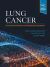 Lung Cancer