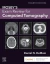 Mosby's Exam Review for Computed Tomography