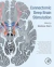 Connectomic Deep Brain Stimulation