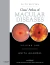 Gass' Atlas of Macular Diseases