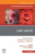 Lung Cancer, An Issue of Hematology/Oncology Clinics of North America