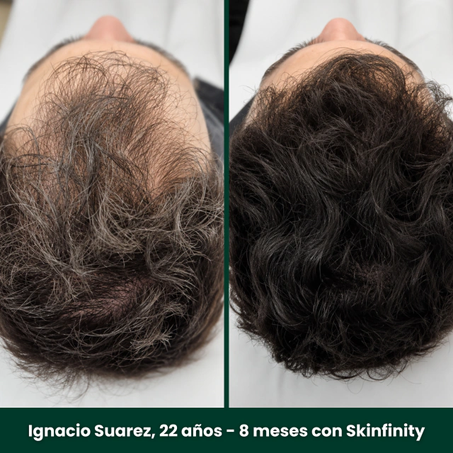 Testimonio de un cliente de Skinfinity