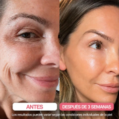 ZYLORA® Tratamiento Nocturno Intensivo | Firmeza y Luminosidad - tienda online