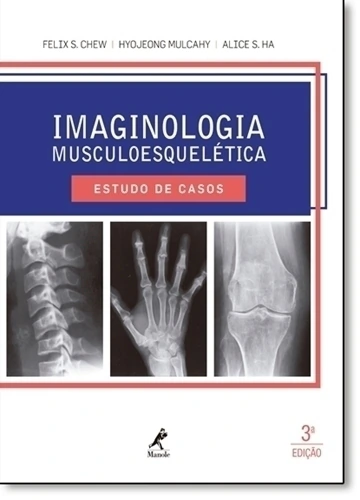 Imaginologia Musculoesquelética: Estudo de Casos