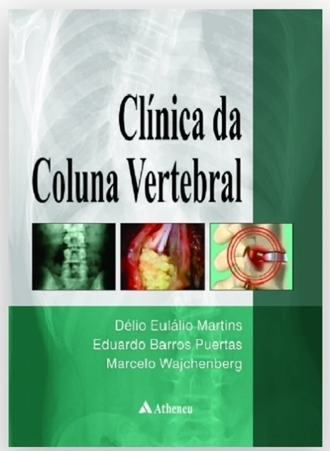 ***Clinica Da Coluna Vertebral***