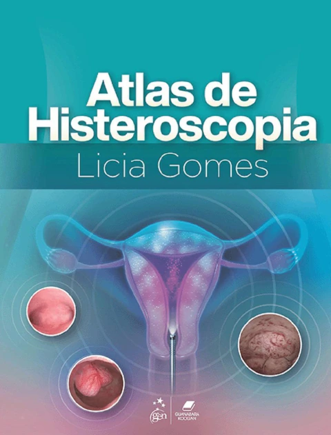 Atlas de Histeroscopia