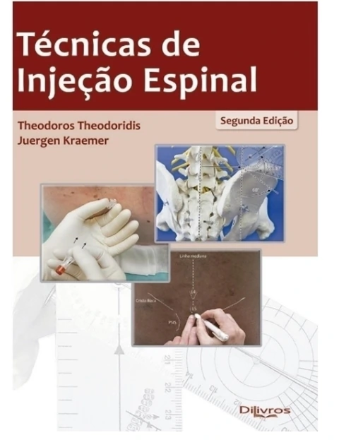TECNICAS DE INJENCAO ESPINAL