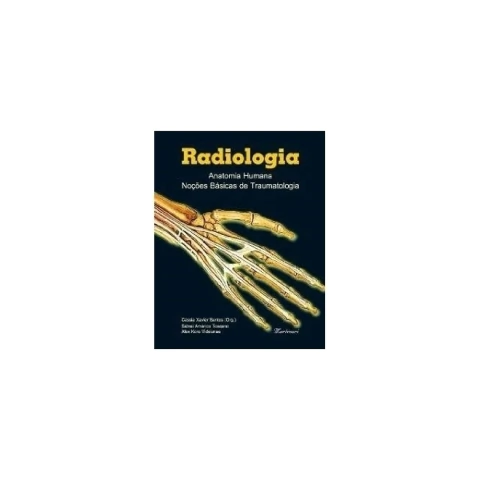 Radiologia - Anatomia Humana Noções Básicas de Traumatologia