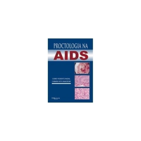Proctologia na AIDS