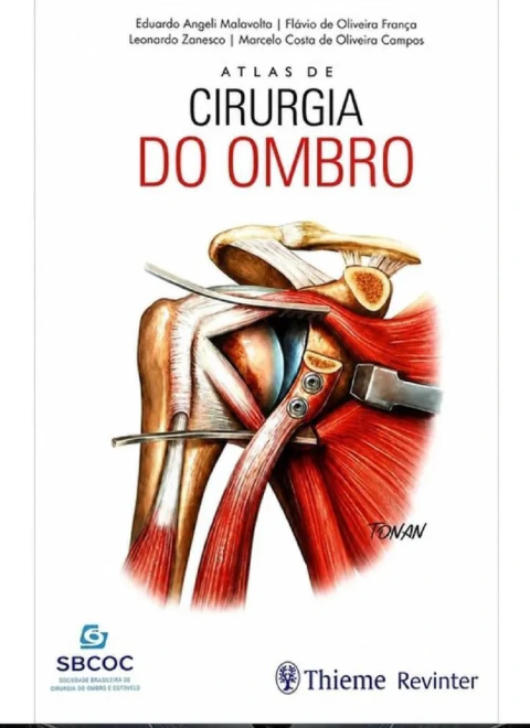 Atlas de Cirurgia do Ombro