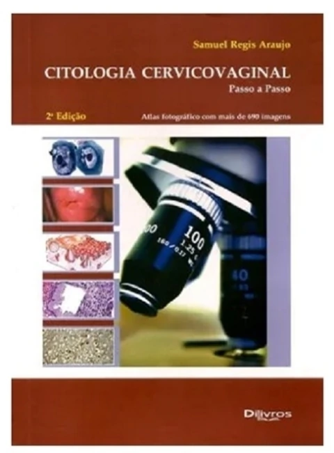 Citologia Cervicovaginal - Passo a Passo