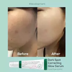 Axis-y Dark Spot Correcting Glow Serum Clareador De Machas - loja online