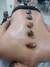Terapias de SPA