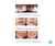 HYAL MOISTURIZING SYSTEM 8 acido hialuronico (3 jeringa 1MM) - CIENTIFIC - comprar online