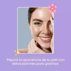 Parches para granitos - con niacinamida- Mely 24 u - MARIA LISAN MAKE UP STORE