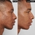 The INKEY List - Mandelic Acid Treatment - comprar online
