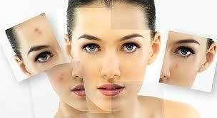 Ácido Kojico 1% 30ml + Sabonete Peeling 60ml Manchas E Rugas na internet