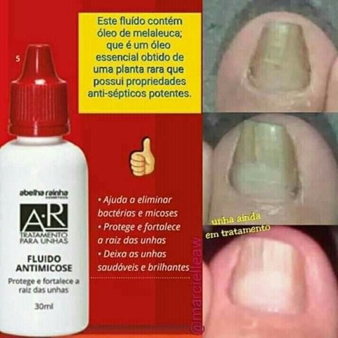 Tratamento Para Unhas- Fluído Antimicose - Abelha Rainha na internet