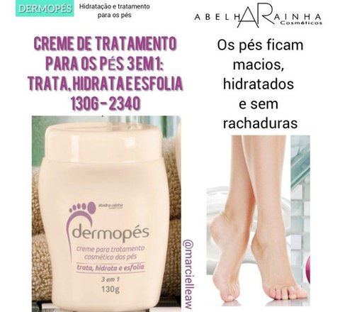 Creme Para Tratamento Cosmético Dos Pés - Dermopés - comprar online