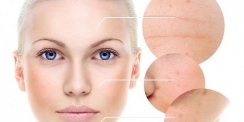 Ácido Mandélico 40% 30ml + Neutrlizante - Clean Face Skin