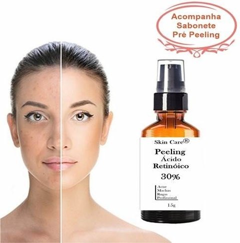 Acido Retinóico 30% Puro Cor Base + Sabonete Pré Peeling