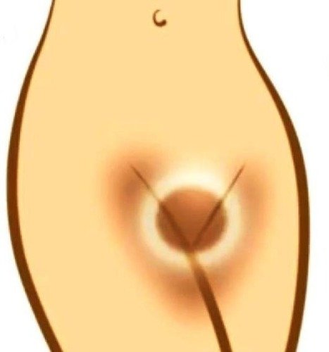 Clareador Intimo 30g Virilha, Axila E Coxas - comprar online