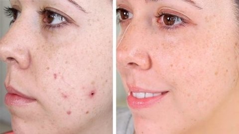 Peeling Ácido Glicólico 10% Gel Creme Toque Seco 30g - Clean Face Skin