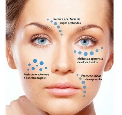 Adipofill 5% Rugas, Bigode Chines E Flacidez 30ml - comprar online