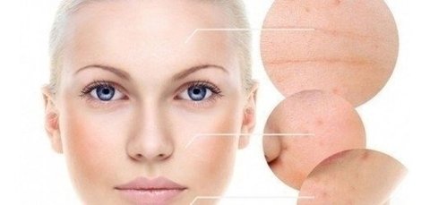 Sabonete Ácido Hidroquinona 30%( Acne, Manchas E Rugas)110ml - Clean Face Skin