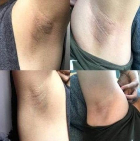 Clareador Intimo Axila, Virilha Entre Coxas 30g na internet