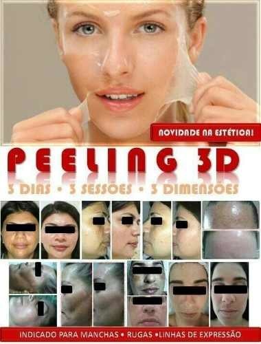 Ácido Glicolico Peeling 3d 30ml + Sabonete + Neutralizante - Clean Face Skin