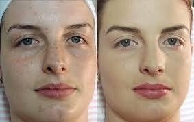 Ácido Kojico 20% 30ml + Sabonete Peeling 60ml - loja online