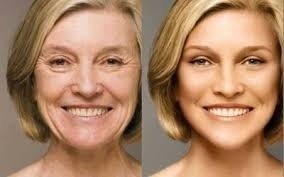 Ácido Tricloroacético 30% 30ml ( Tca-ata ) + Vitamina C 20% - Clean Face Skin