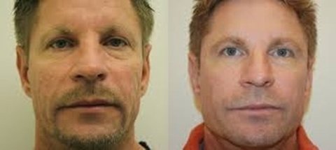Ácido Peeling Kojico 20% + Tranexâmico 5% + Vitamina C 30% - Clean Face Skin